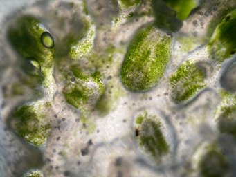 Microscopic image of a cross-section through one of the ascidian. The green dots are cyanobacteria that produce the patellamides. Microscopic image of a cross-section through one of the ascidian