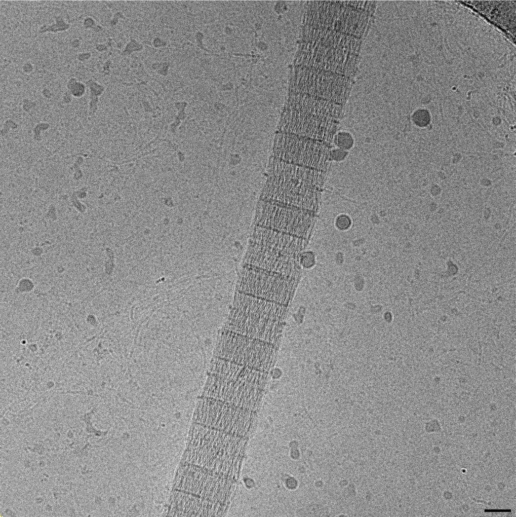 High-resolution electron microscope image displaying a collagen with parallel segmented patterns, surrounded by a textured background.